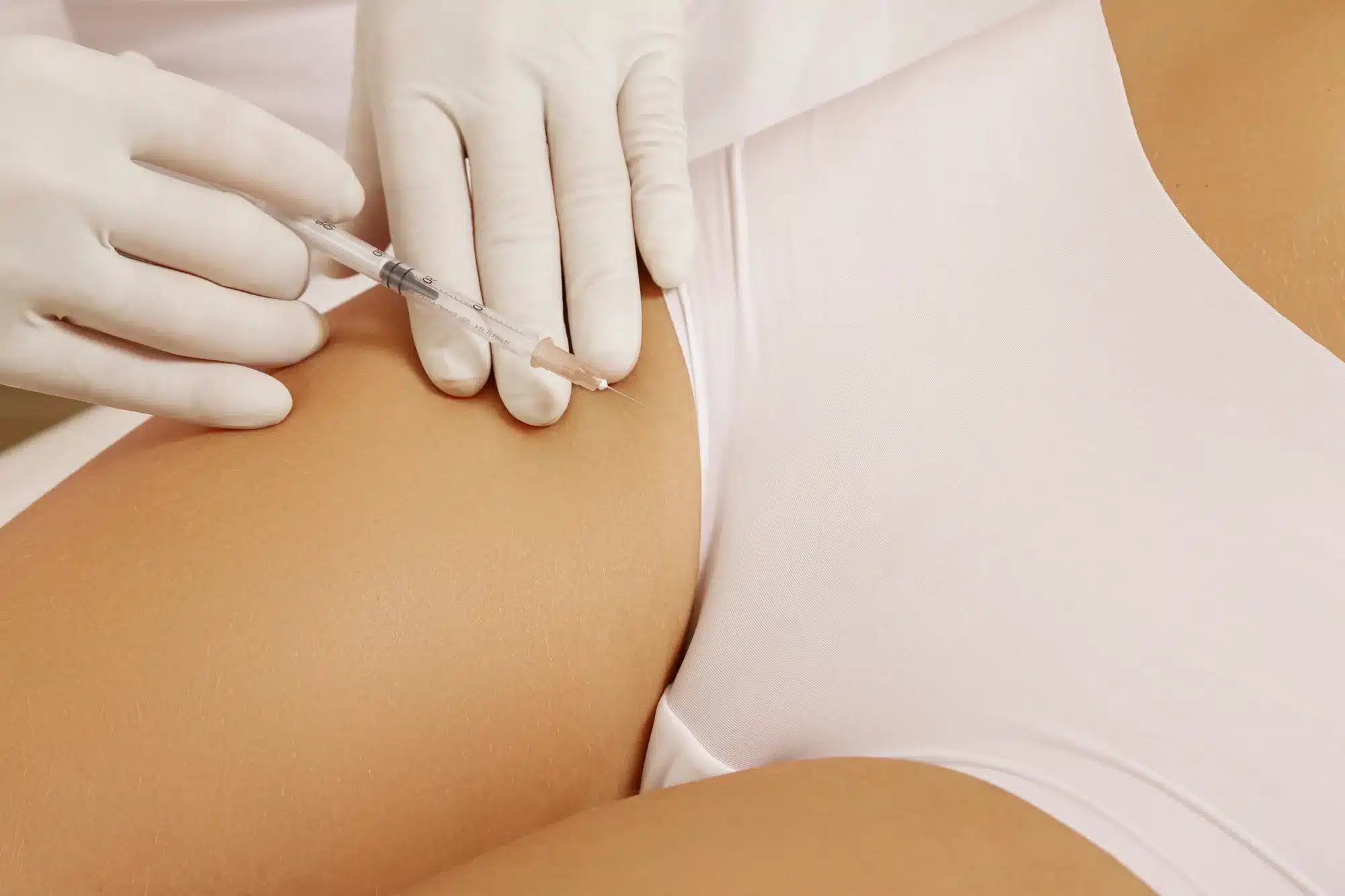 Labia Major Augmentation